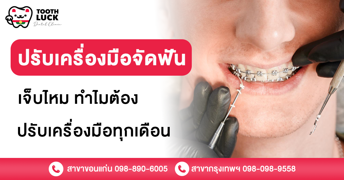 ปรับเครื่องมือจัดฟัน