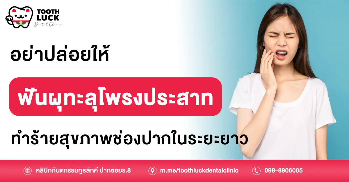 ฟันผุทะลุโพรงประสาท