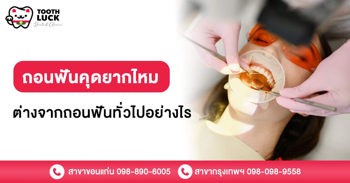 ถอนฟันคุด