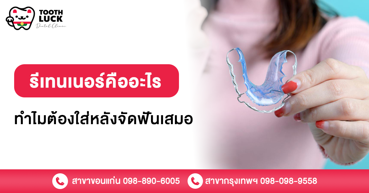 รีเทนเนอร์