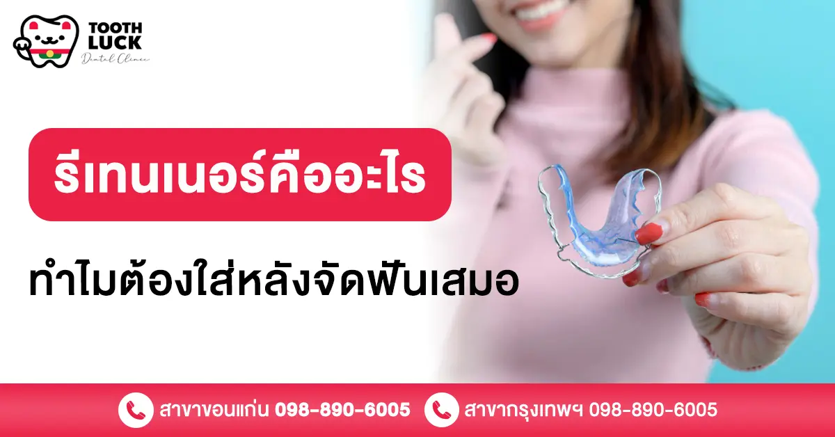 รีเทนเนอร์