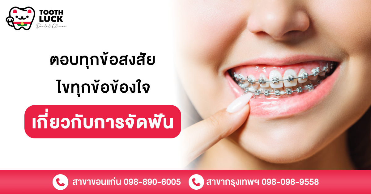 การจัดฟัน