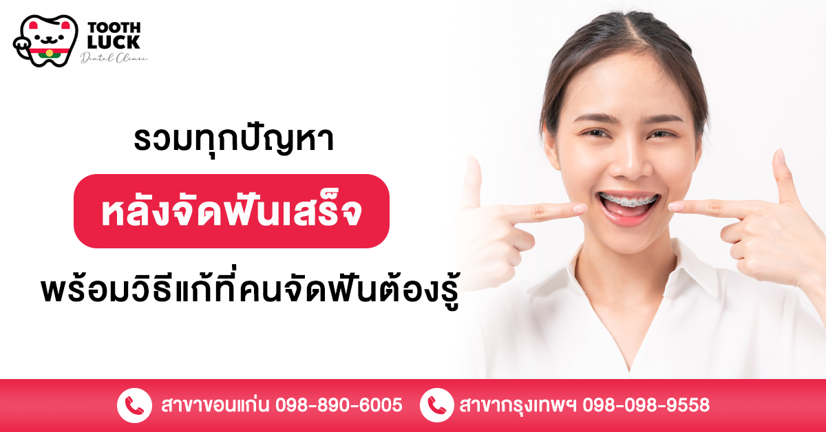 จัดฟันเสร็จ