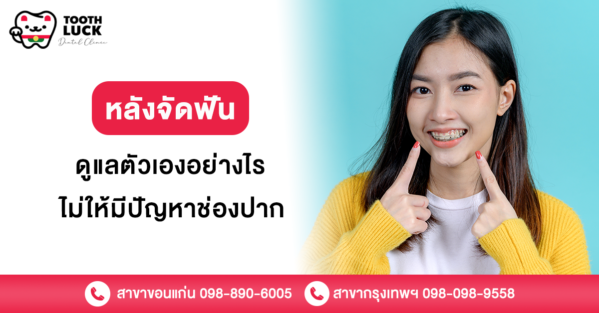 หลังจัดฟัน