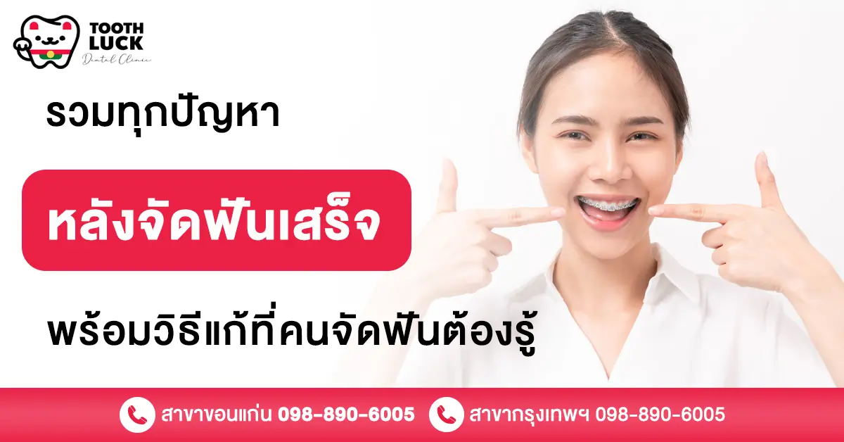 จัดฟันเสร็จ