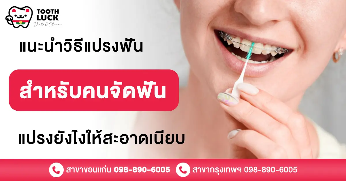 วิธีแปรงฟันสําหรับคนจัดฟัน