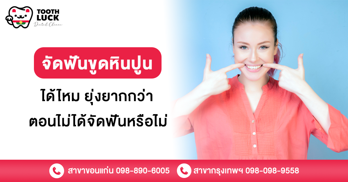 จัดฟันขูดหินปูน