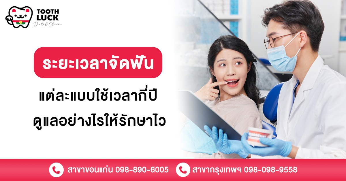 ระยะเวลาจัดฟัน