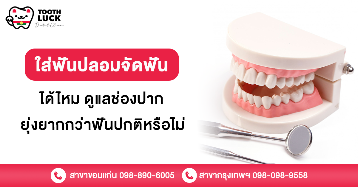 ใส่ฟันปลอมจัดฟัน