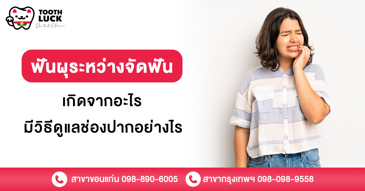 ฟันผุระหว่างจัดฟัน