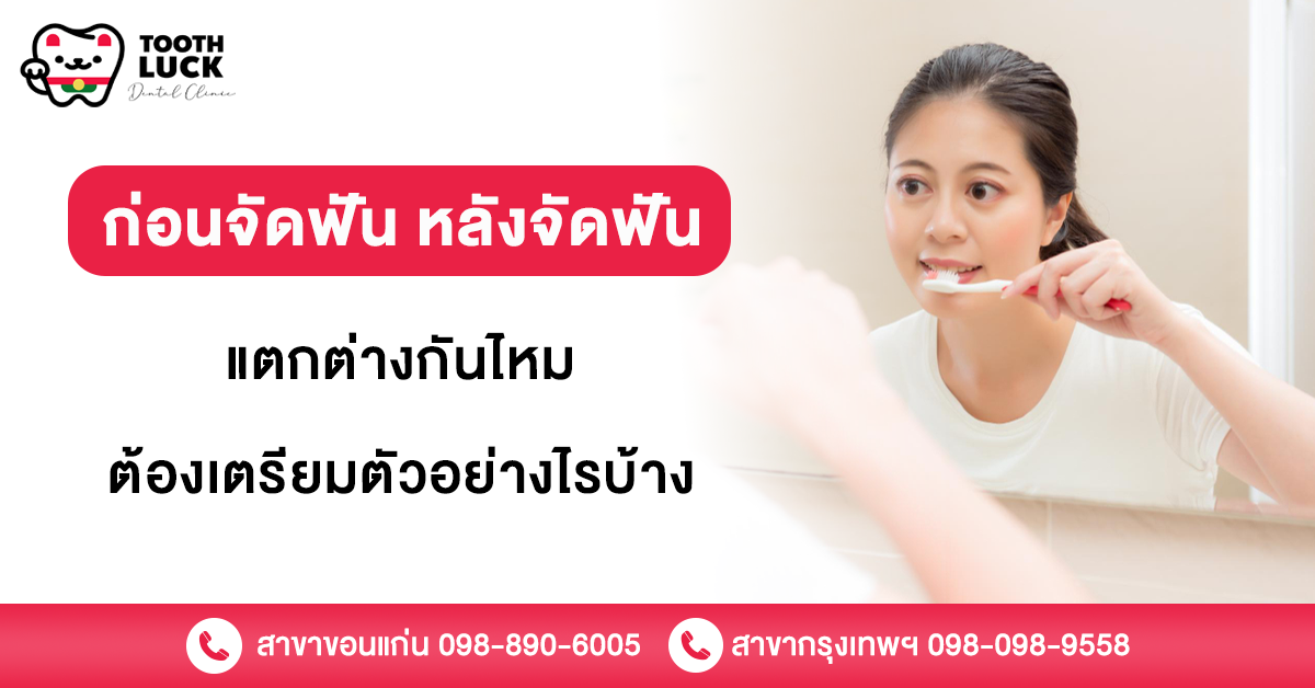 ก่อนจัดฟัน หลังจัดฟัน