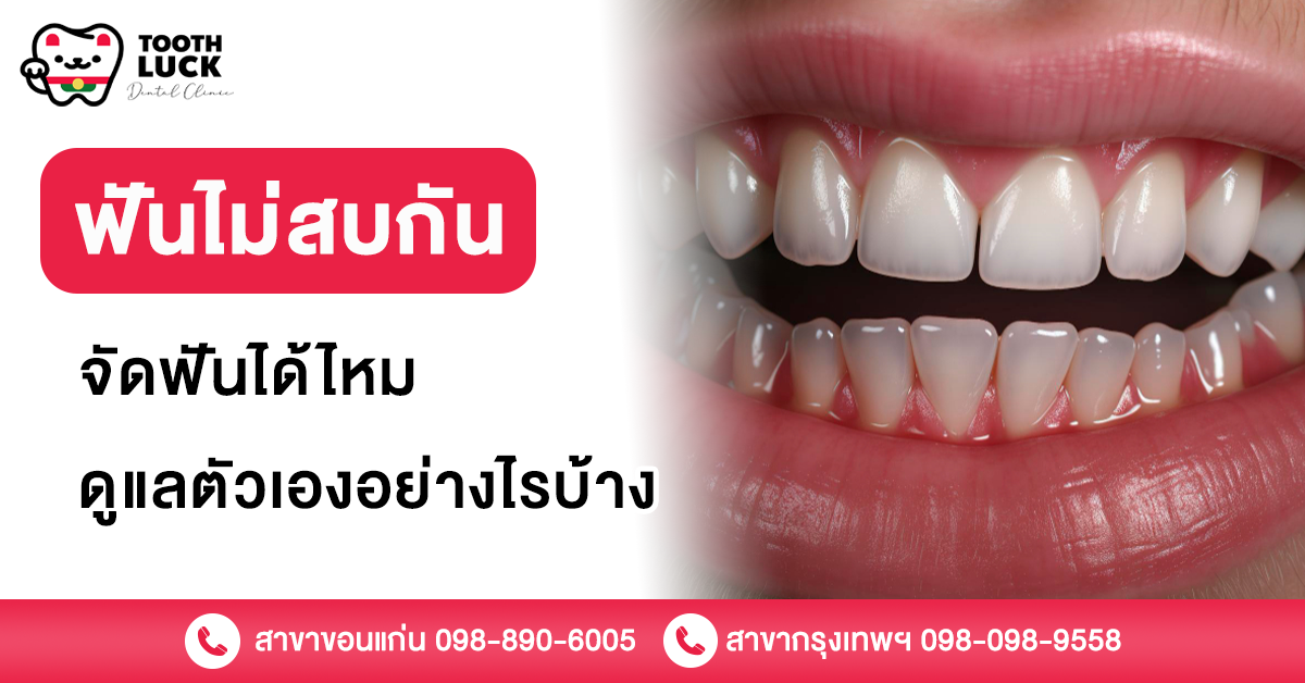 ฟันไม่สบกัน