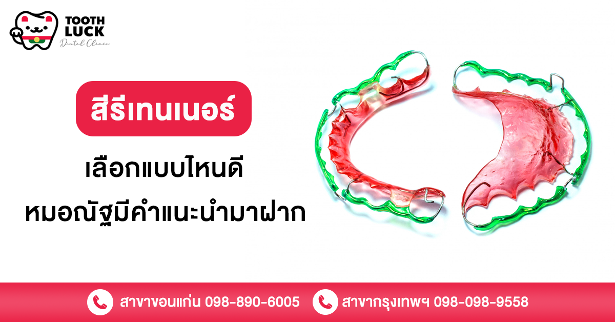 สีรีเทนเนอร์