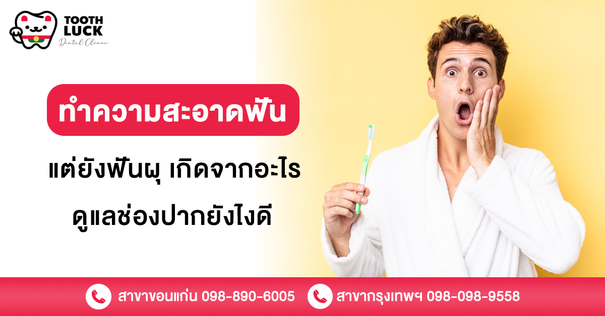 ทำความสะอาดฟัน