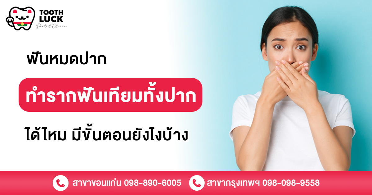 รากฟันเทียมทั้งปาก