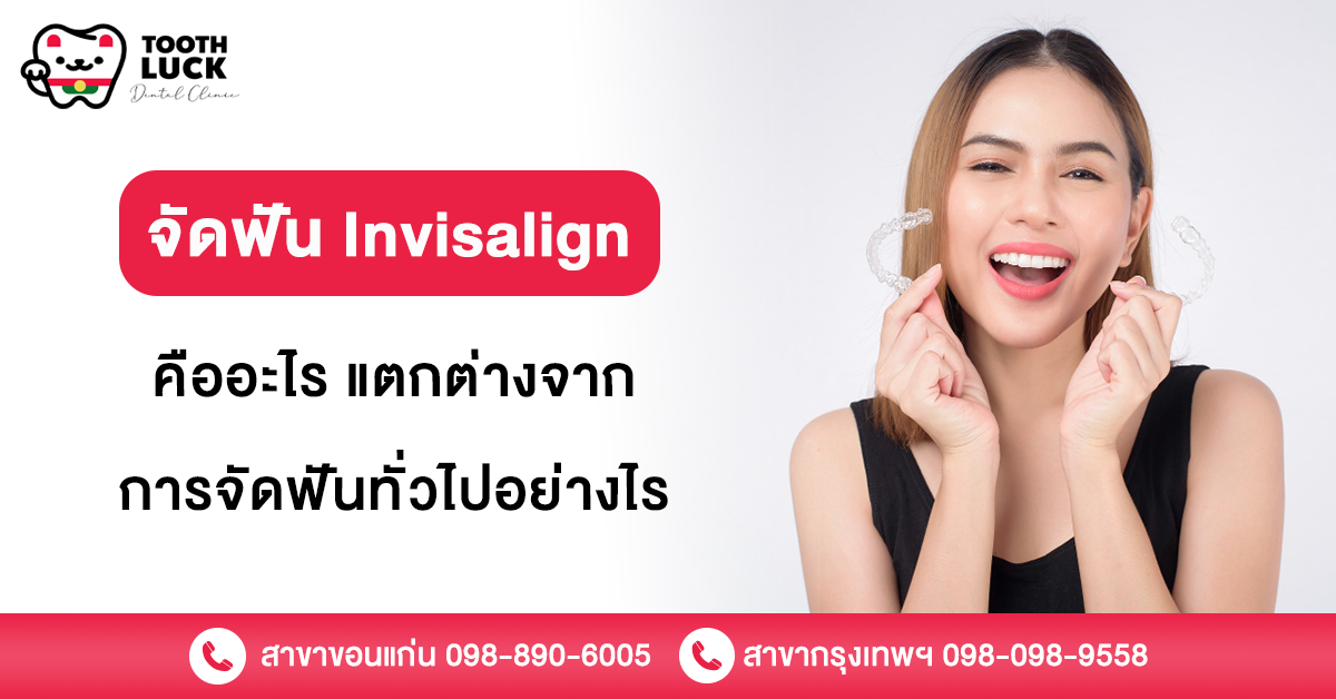 จัดฟัน Invisalign คืออะไร แตกต่างจากการจัดฟันทั่วไปอย่างไร