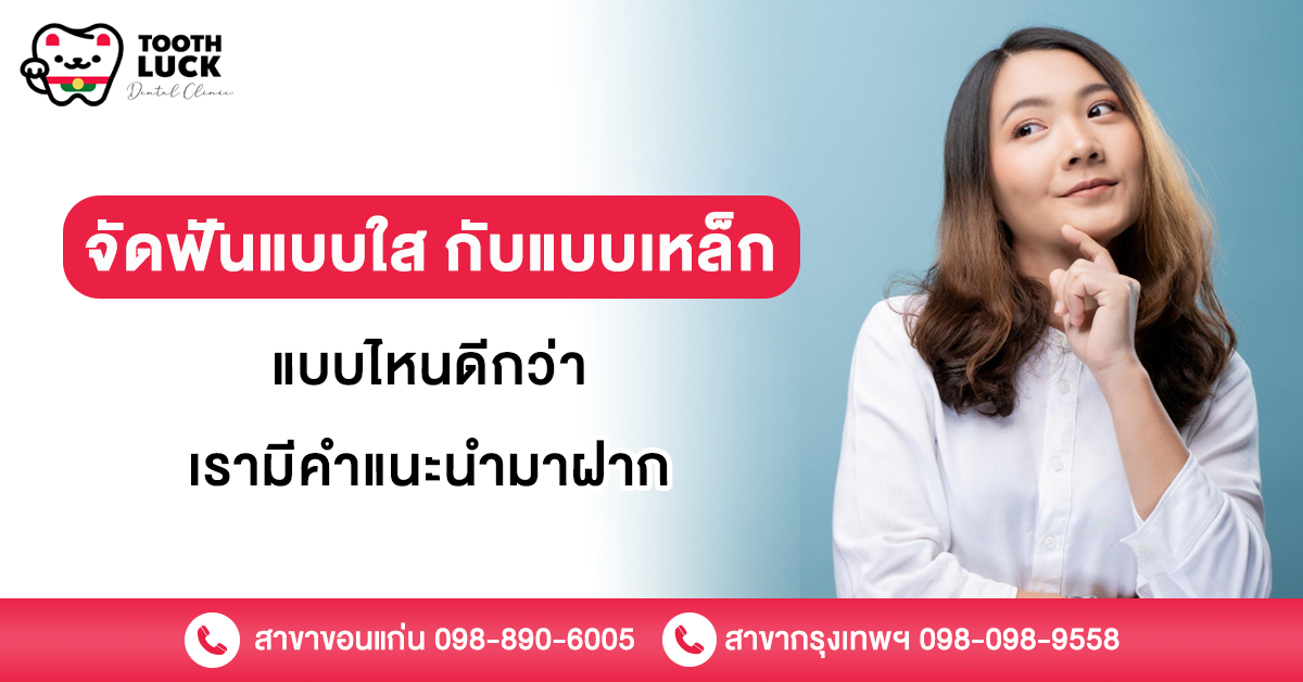 จัดฟันแบบใส กับ แบบเหล็ก