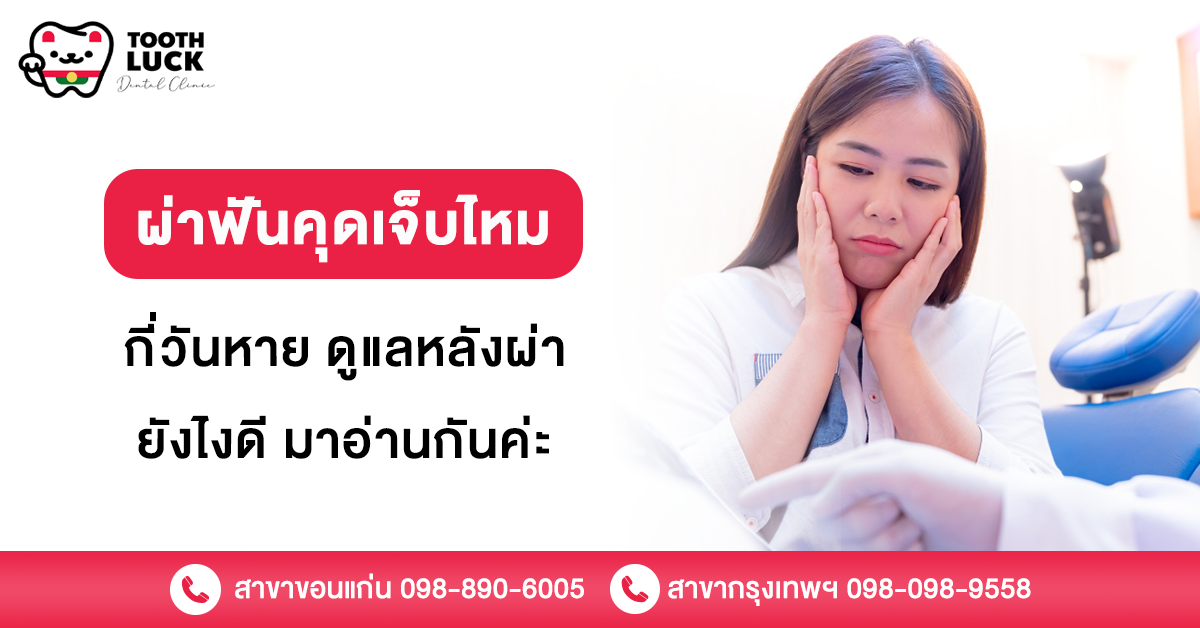 ผ่าฟันคุด