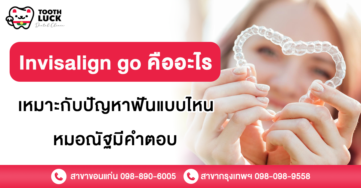 Invisalign go คืออะไร เหมาะกับปัญหาฟันแบบไหน หมอณัฐมีคำตอบ