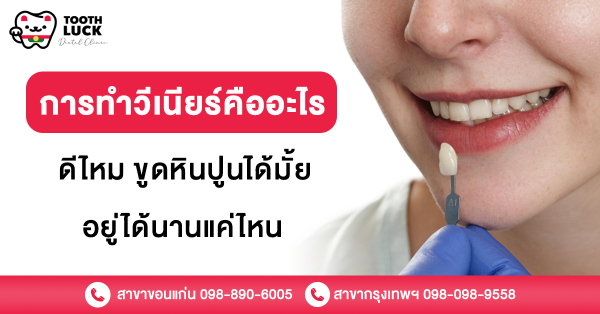 การทำวีเนียร์