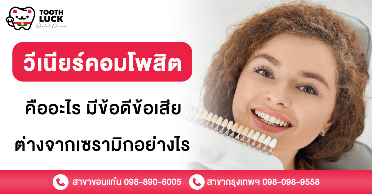 วีเนียร์คอมโพสิต