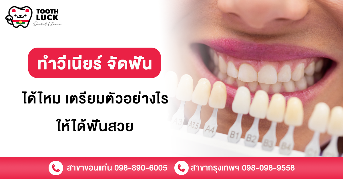 ทําวีเนียร์
