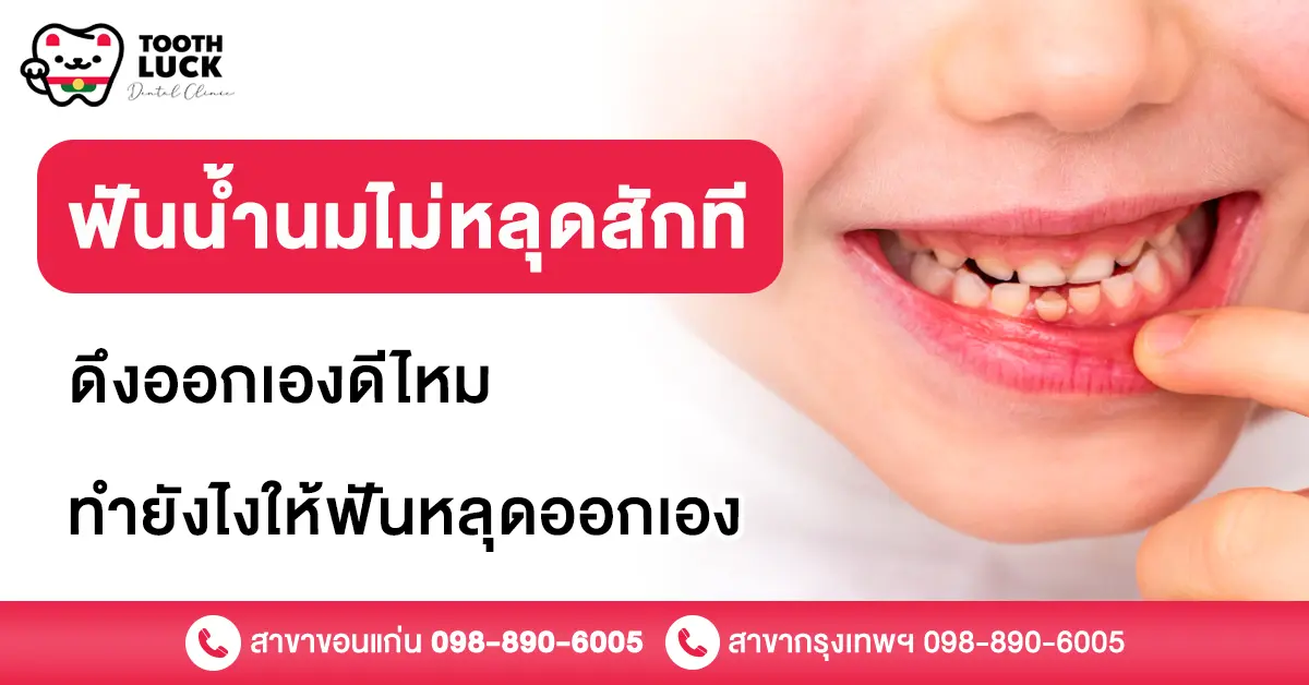 ฟันน้ำนมไม่หลุดสักที