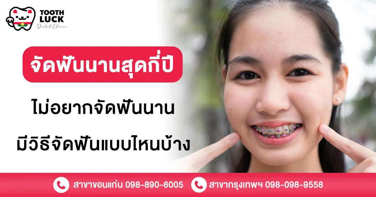 จัดฟันนาน