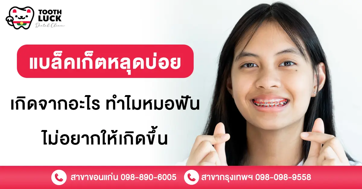แบล็คเก็ตหลุดบ่อย