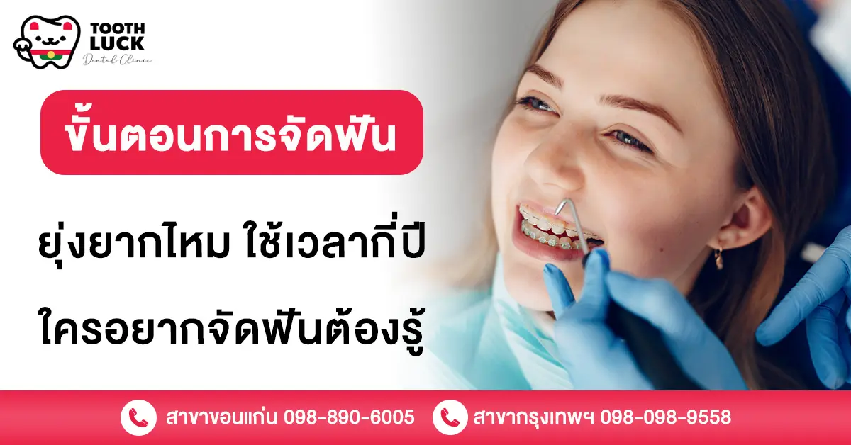 ขั้นตอนการจัดฟัน