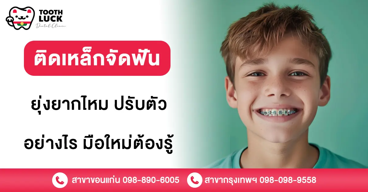 ติดเหล็กจัดฟัน