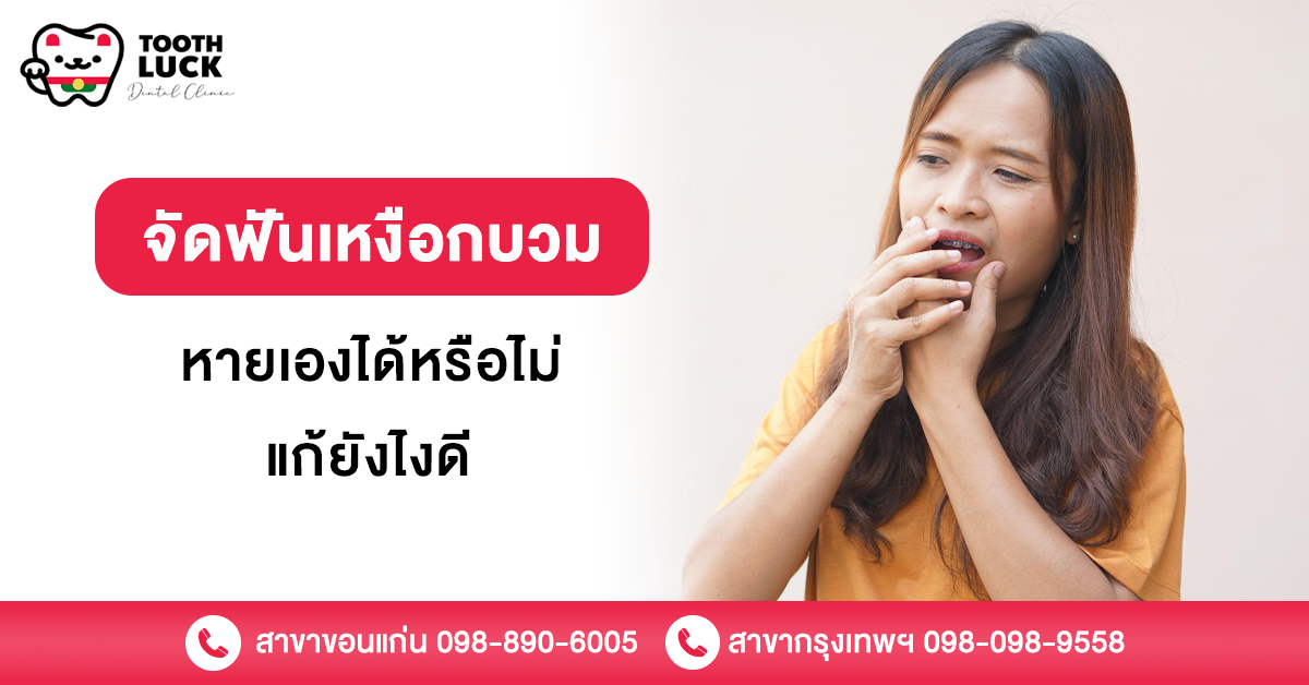 จัดฟันเหงือกบวม