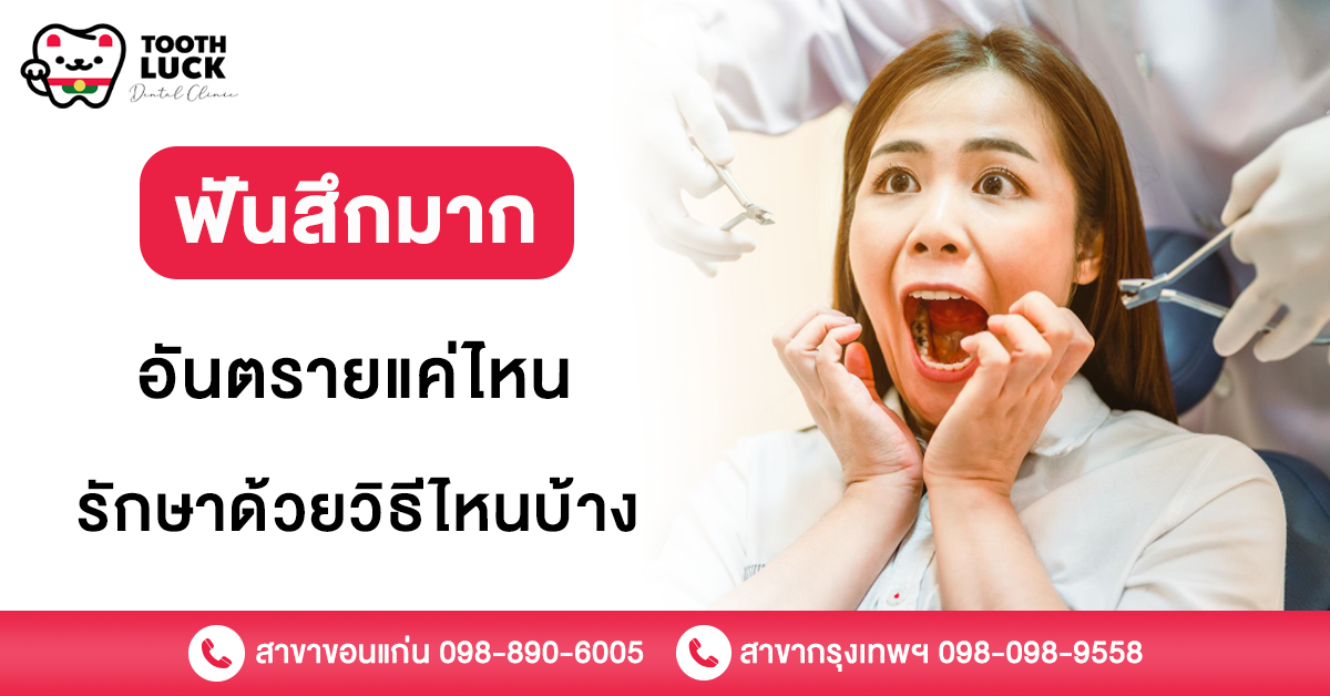 ฟันสึก