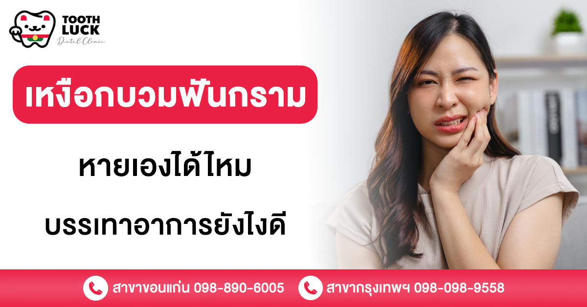 เหงือกบวมฟันกราม