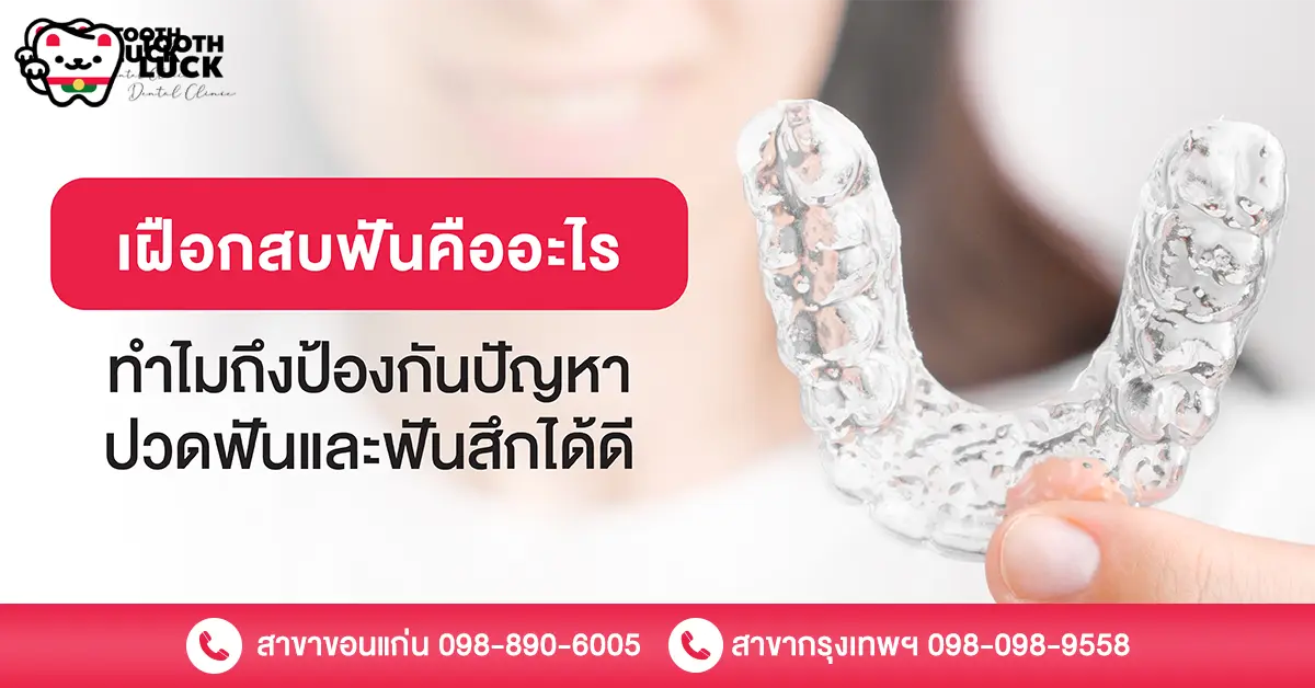 เฝือกสบฟัน