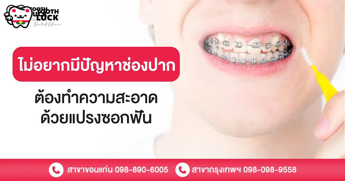 แปรงซอกฟัน