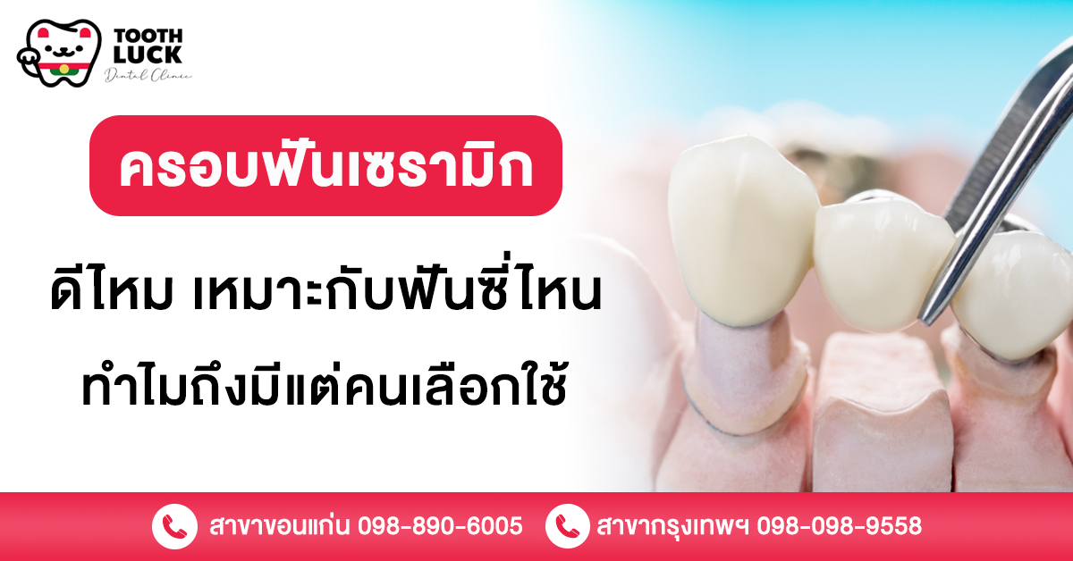 ครอบฟันเซรามิก
