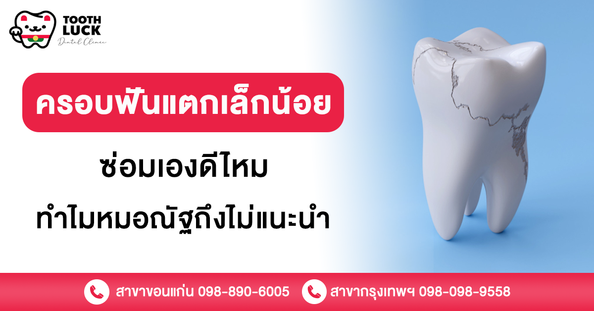 ครอบฟันแตกเล็กน้อย