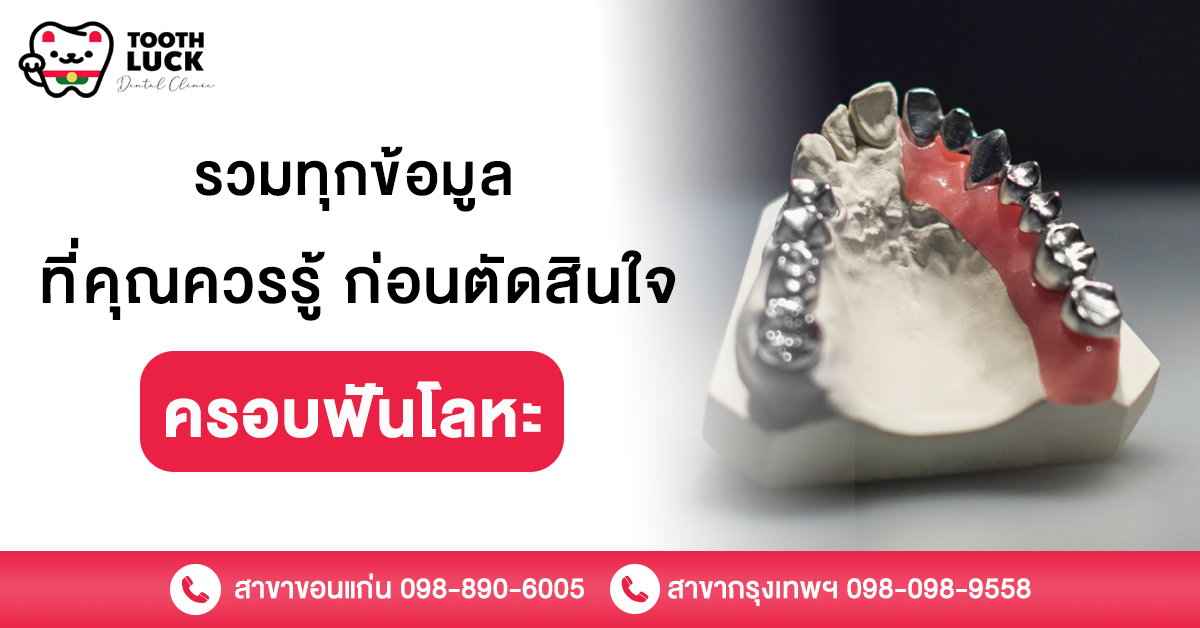 ครอบฟันโลหะ