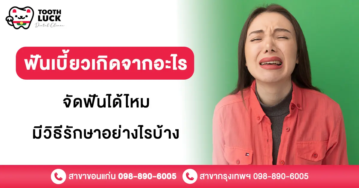 ฟันเบี้ยว