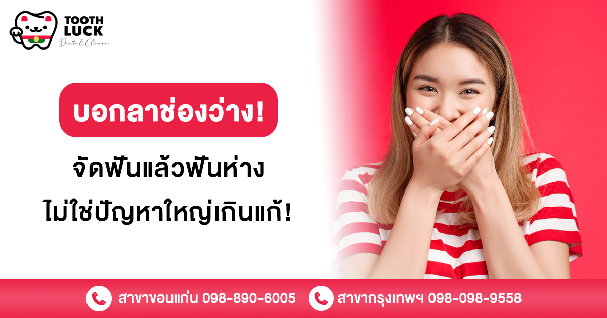 บอกลาช่องว่าง! จัดฟันแล้วฟันห่าง ไม่ใช่ปัญหาใหญ่เกินแก้!