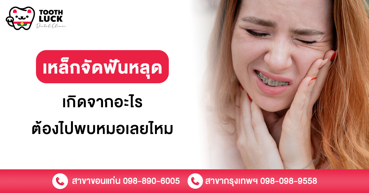 เหล็กจัดฟันหลุด