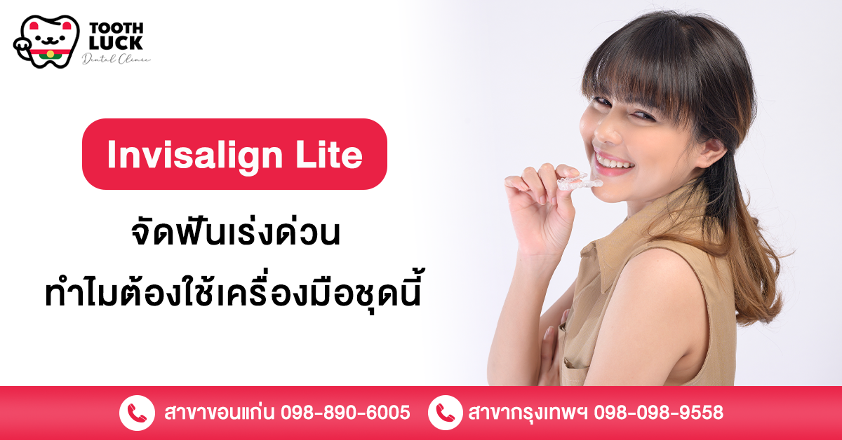 Invisalign lite