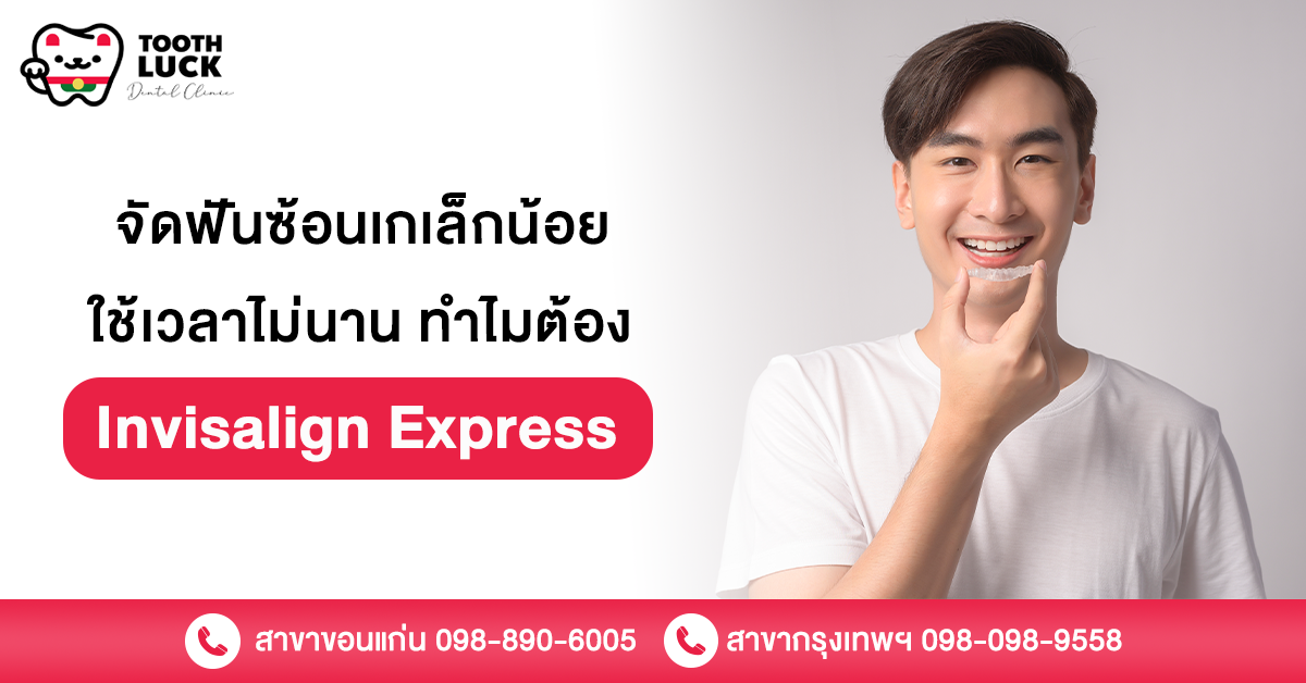 Invisalign express