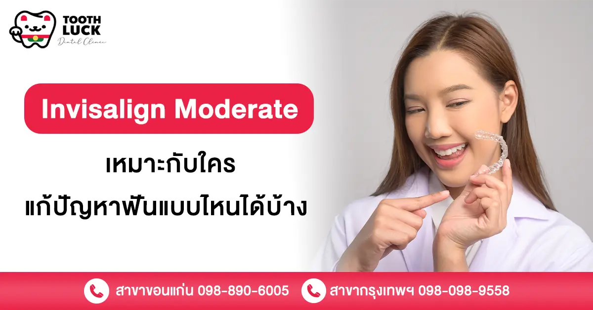 Invisalign Moderate