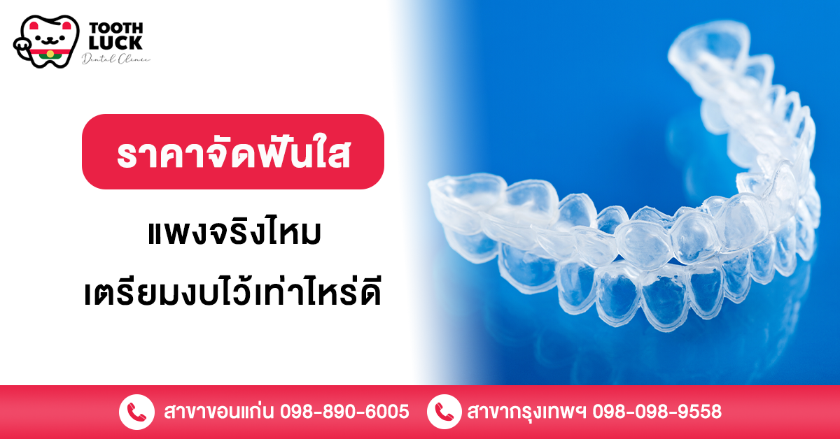 ราคาจัดฟันใส