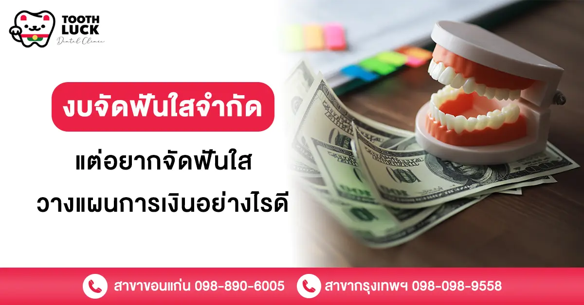 งบจัดฟันใส