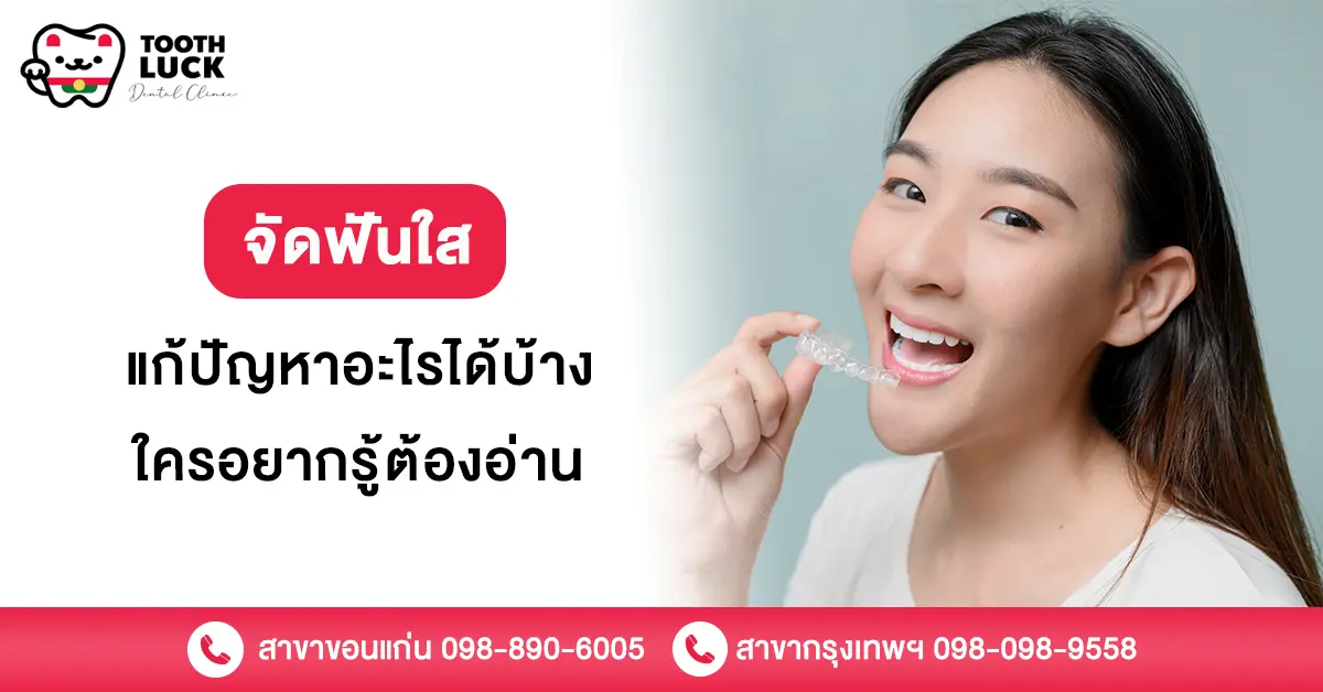 จัดฟันใส แก้
