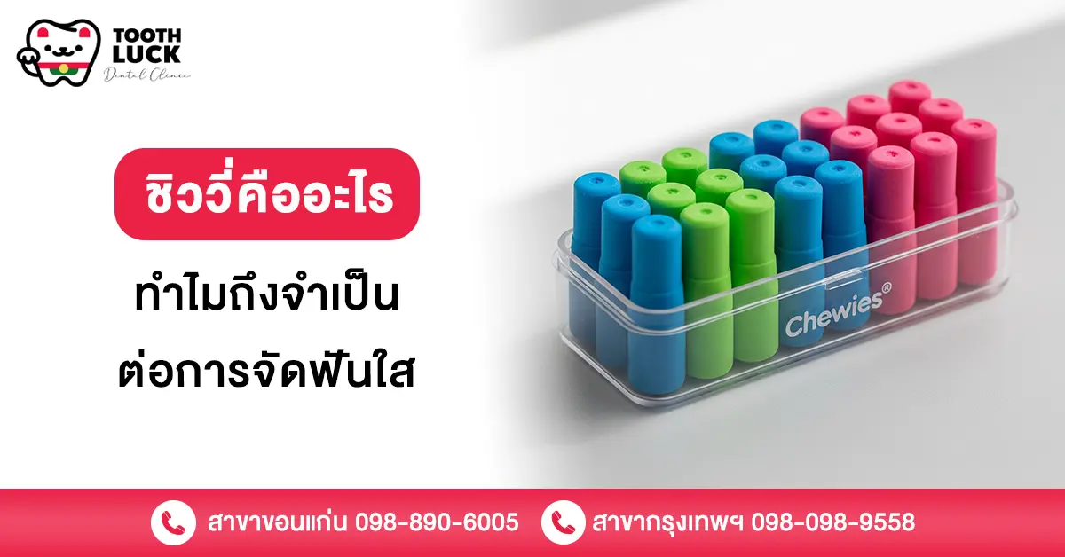 ชิววี่
