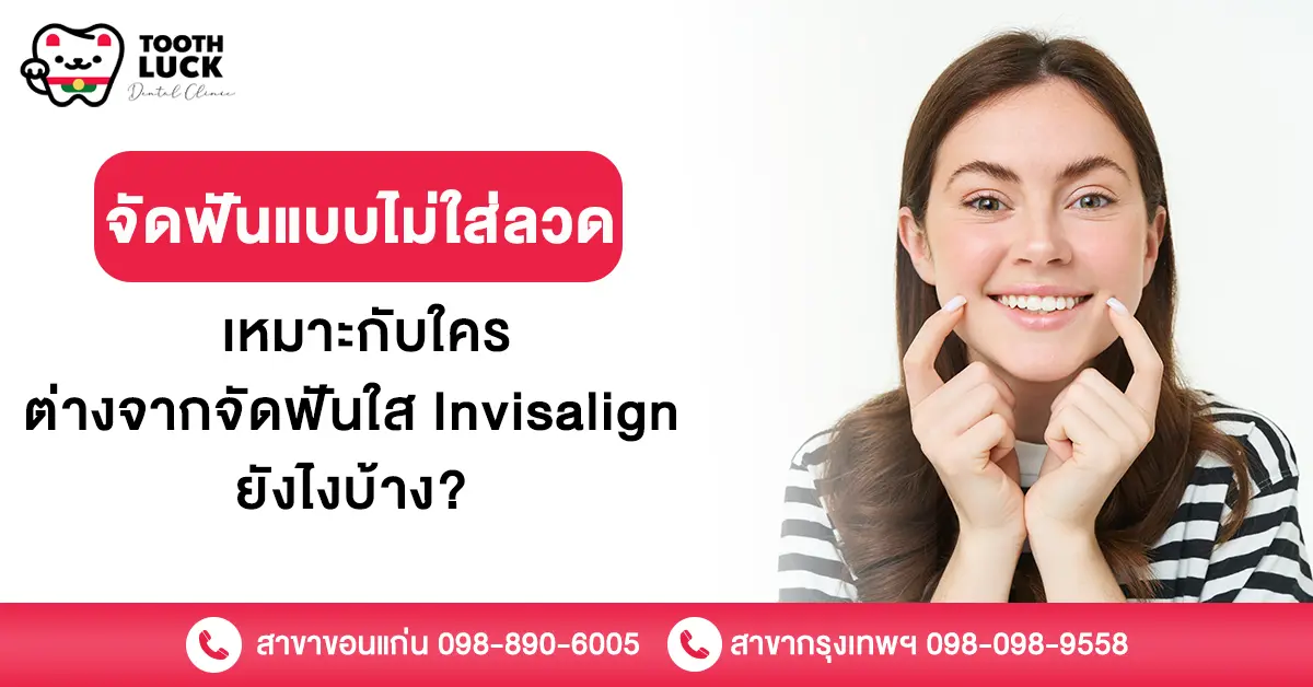 จัดฟันแบบไม่ใส่ลวด เหมาะกับใคร ต่างจากจัดฟันใส Invisalign ยังไง